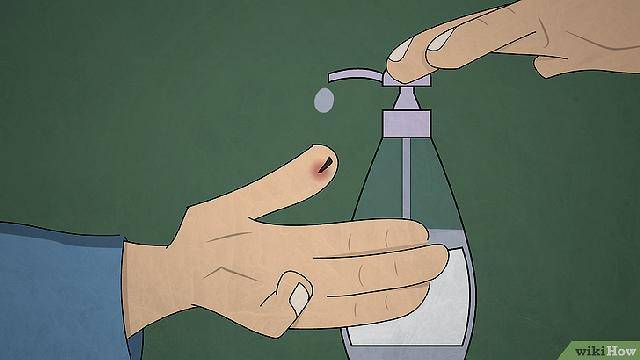 Как вылечить кариес у детей?