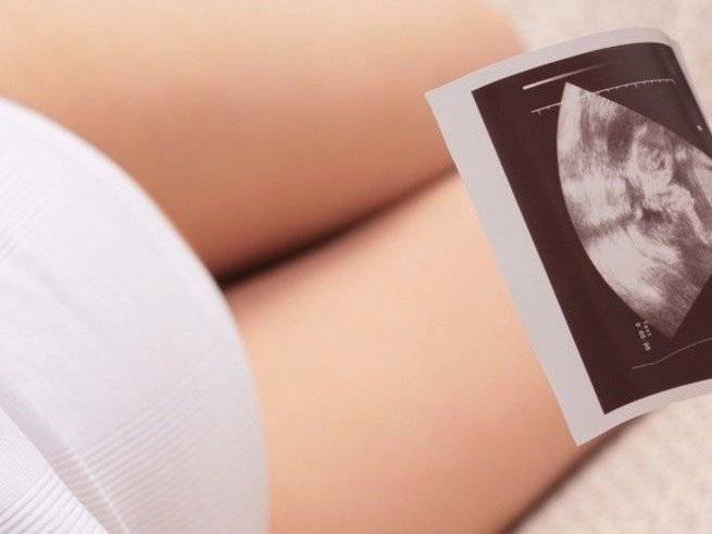 5 вопросов о третьем скрининге при беременности с подробными ответами врача-гинеколога