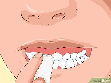 Удаление зубов. сколько зубов можно удалить одновременно?