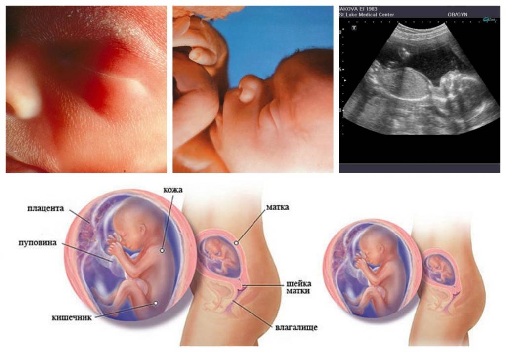 Срок беременности 11 недель — ощущения, анализы, узи, выделения, плод