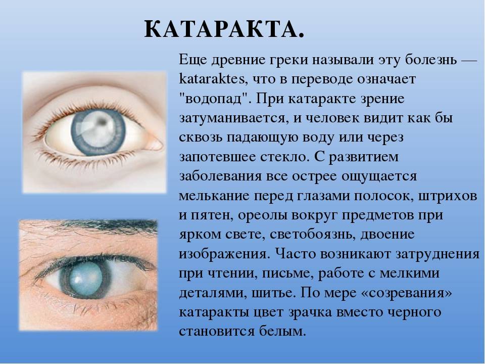 Видит глаза как пишется. Поражение органов зрения. Сообщение о заболеваниях глаз. Нарушение органов зрения. Нарушение зрения заболевания.