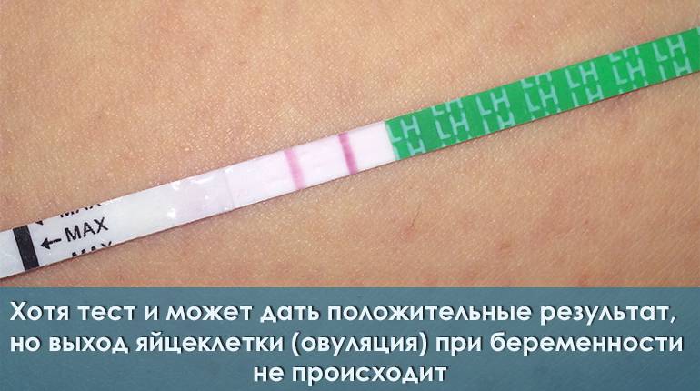 Киста яичника при беременности
