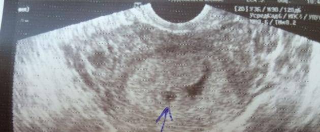 Беременность 4 недели – один из важнейших этапов в развитии ребенка | компетентно о здоровье на ilive