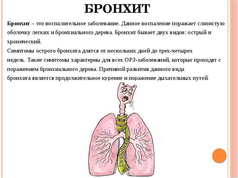 Пневмония у взрослых — 7 опасных симптомов