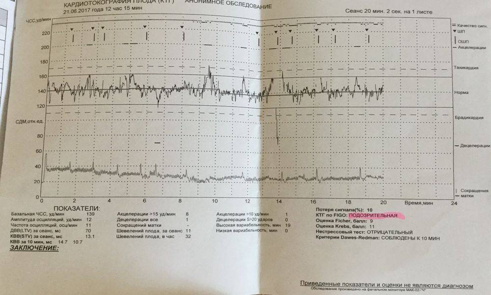 Ктг при беременности: когда и как делают, нормы и расшифровка, подготовка к кардиотокографии плода / mama66.ru