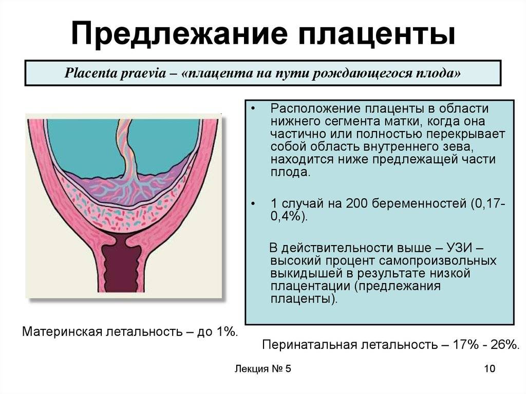 Чем грозит краевое, полное (центральное) предлежание плаценты и как эта патология беременности отражается на родах