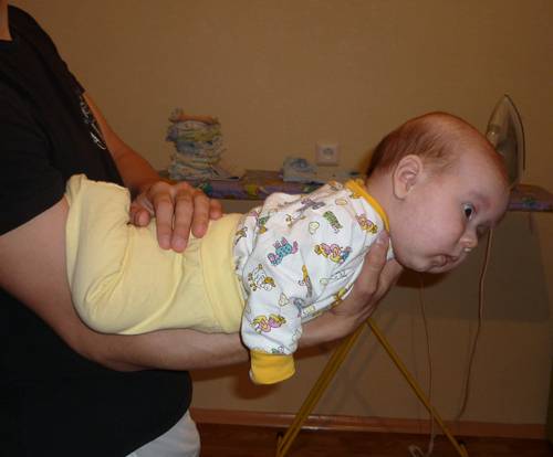 Ребенок в 3 месяца не держит голову: причины и как лечить