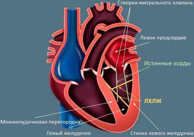 Трабекула в левом желудочке сердца: причины возникновения, признаки, диагностика и лечение