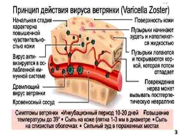 Сколько длится период ветрянки