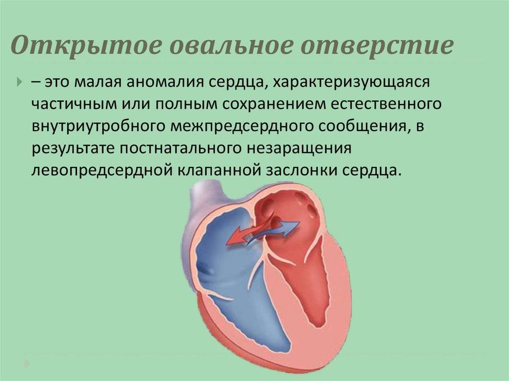 Блокада сердца, лечение блокады пучка сердца, причины блокады сердца.