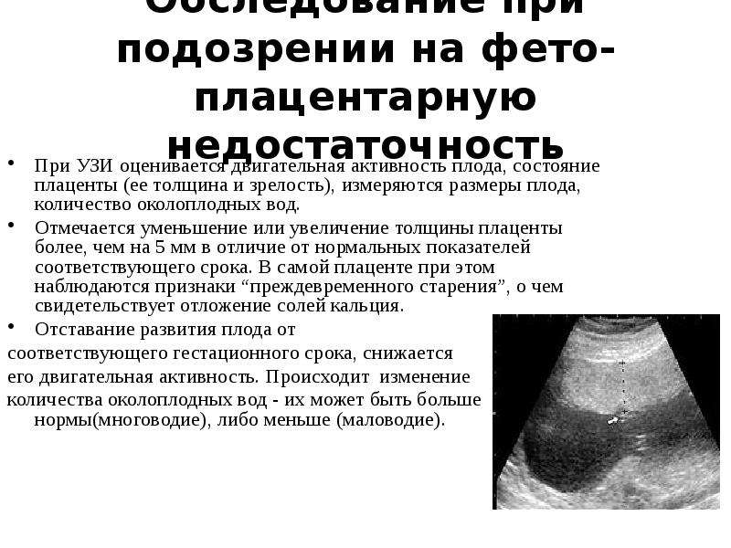 Автореферат и диссертация по медицине (14.00.01) на тему:врожденные заболевания легких плода (течение беременности, диагностика и исходы)