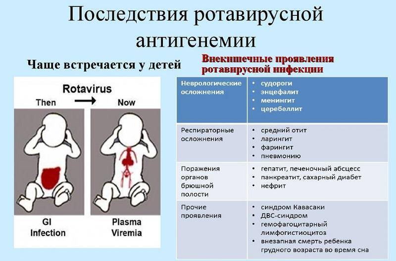 Прививка от ротавирусных инфекций детям до года: плюсы и минусы