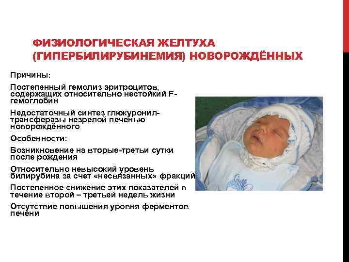 Желтуха у новорожденного – о причинах, опасностях и методах лечения рассказывает  неонатолог клиники isida — клиника isida киев, украина