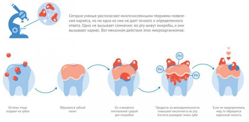 Бутылочный кариес у детей – фото, лечение молочных зубов до 3 лет и после