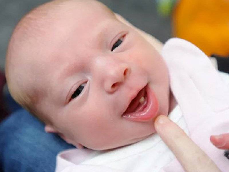 Кто рождается с зубами. почему ребенок родился уже с зубами? ребенок родился с зубами: причины, что делать, удаление, приметы