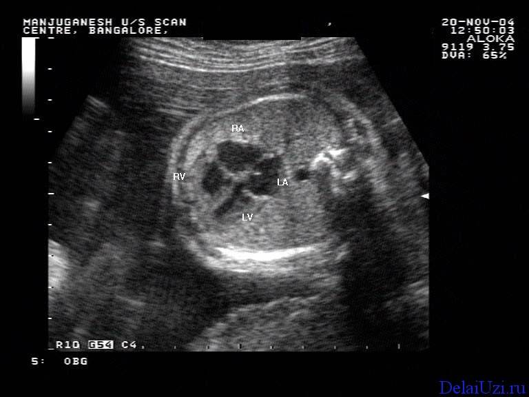 Этапы развития эмбриона | когда начинает биться сердце эмбриона