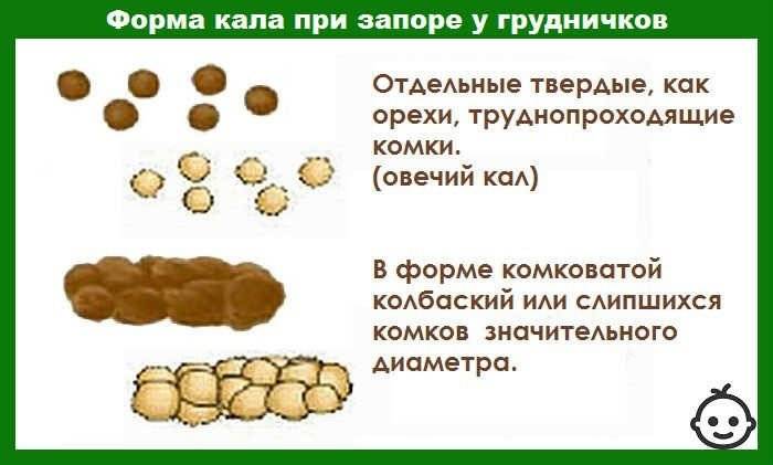Запоры у кормящих мам