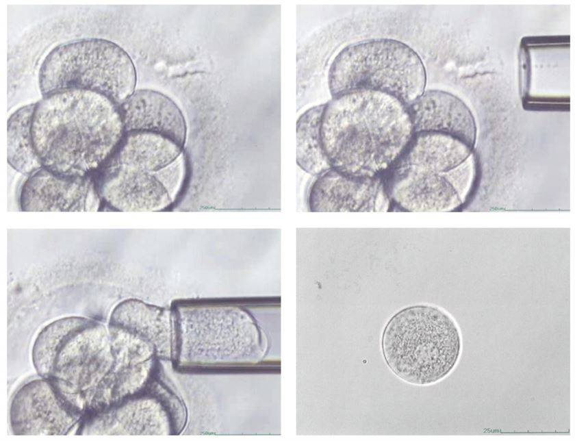Преимплантационное генетическое тестирование эмбрионов