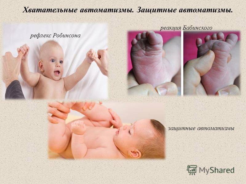 Рефлексы новорожденного: моро, реакции бабинского, бабкина, галанта, таблица по месяцам