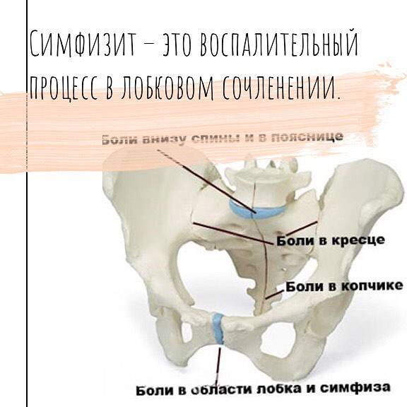 Узи симфиза — лонного сочленения при беременности и после родов