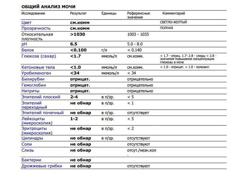 Общий анализ мочи у детей: расшифровка в таблице