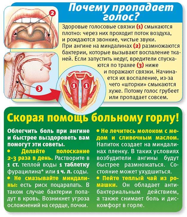 Острый ларингит: воспаления гортани и голосовых связок - лор клиника №1