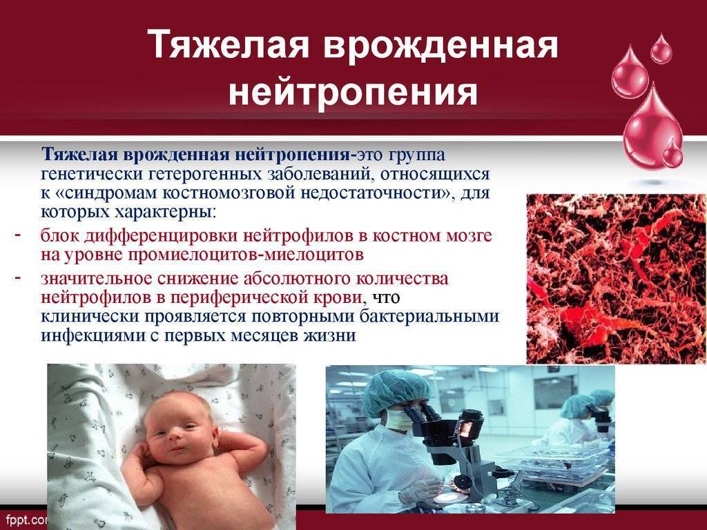 Нейтропения – симптомы, причины, лечение