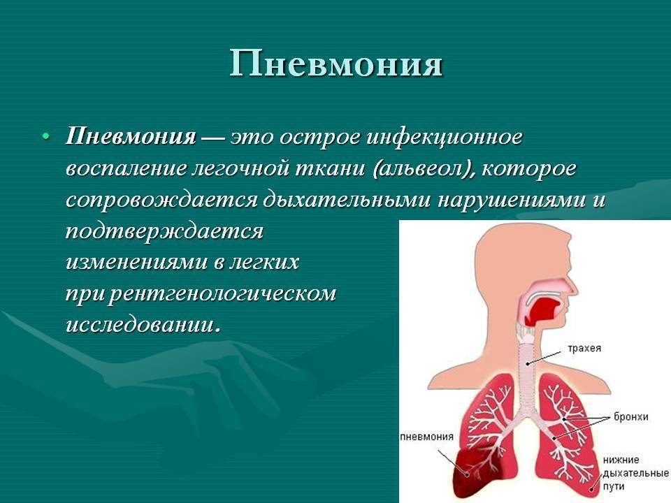 Симптомы пневмонии у детей
