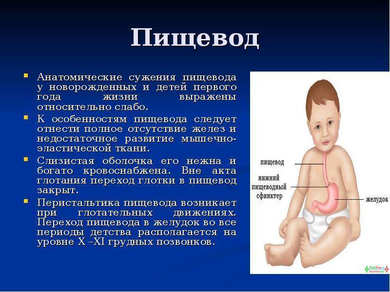 Стеноз привратника желудка (пилоростеноз) у детей