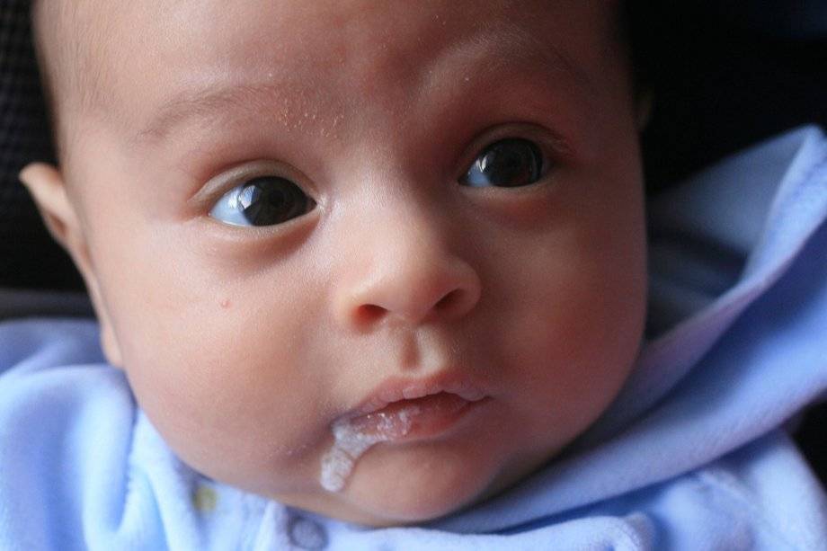Новорожденный срыгнул кровью после кормления | tsitologiya.su