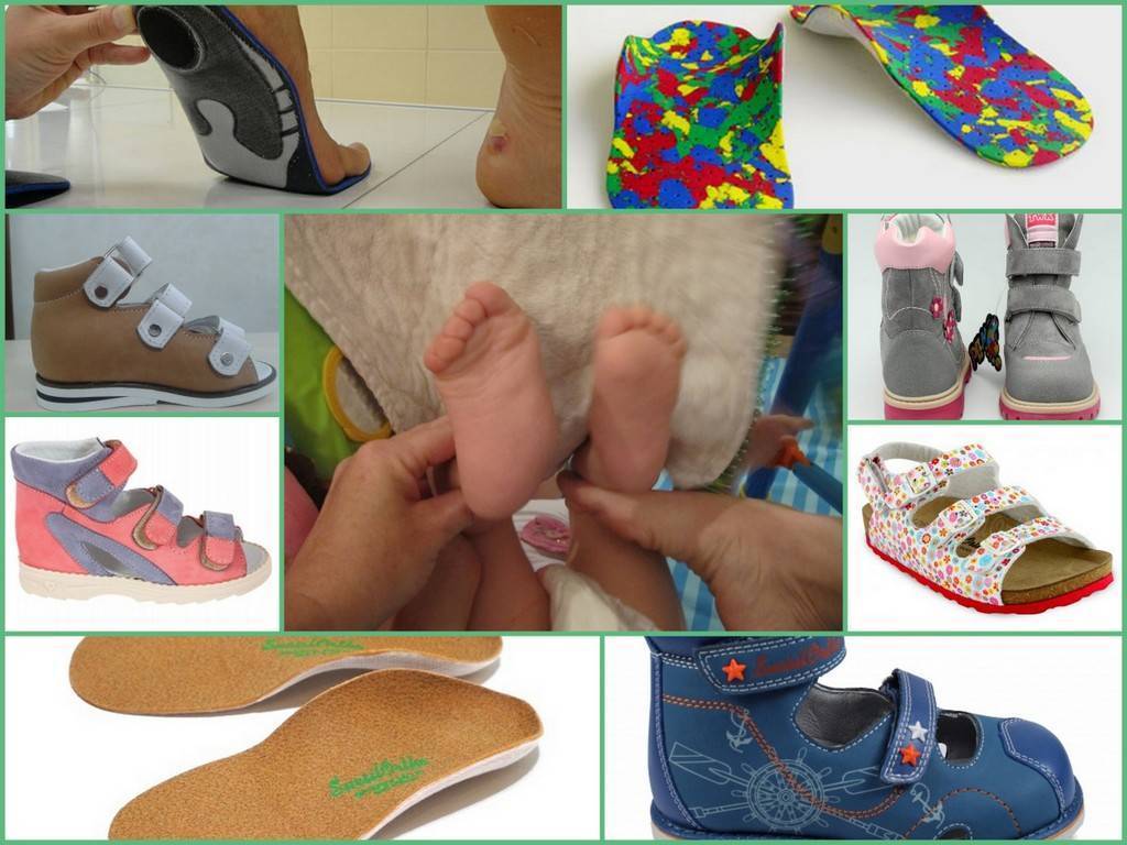 Ортопедическая обувь для малышей