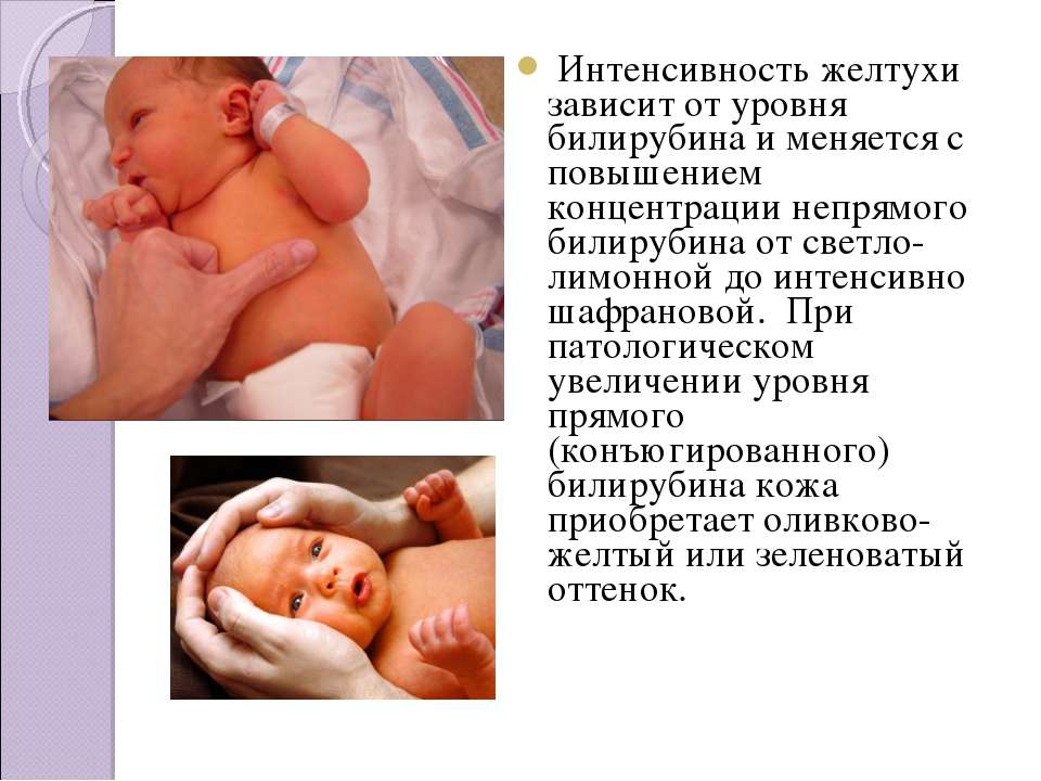 Желтухи новорожденных: причины, лечение, прогноз — онлайн-диагностика