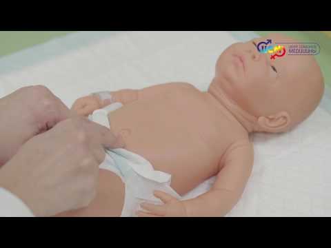 Массаж при пупочной грыже у новорожденных в домашних условиях