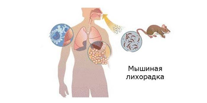 Ротавирусная инфекция (кишечный грипп)