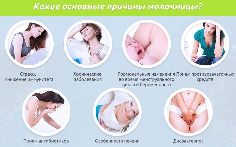 Молочница у женщин, мужчин, причины, симптомы, лечение, как избавиться от молочницы