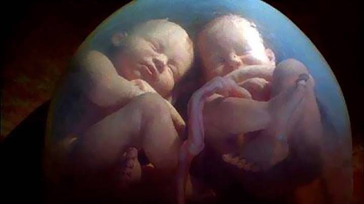 Двойни, тройни, близнецы: почему многоплодие считают осложнением эко? что делать?
