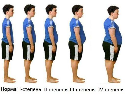 Ожирение у детей. возрастные этапы развития. 7 – 12 (- 14 лет).