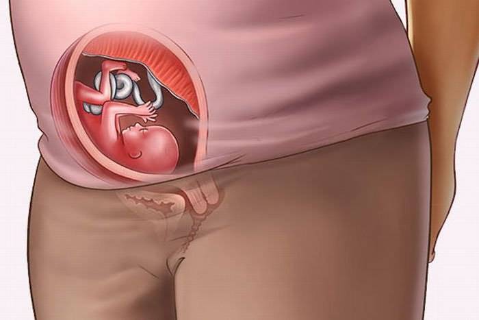 Кровотечение во время ранней беременности: это нормально? причины и признаки имплантационного кровотечения
