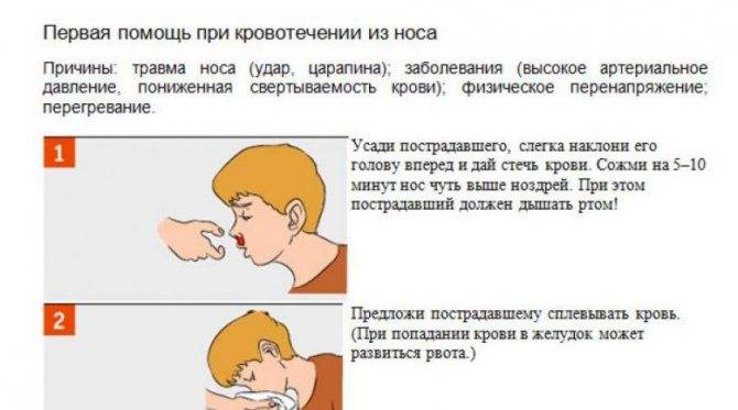 Доктор Комаровский о том, почему течет кровь из носа у ребенка
