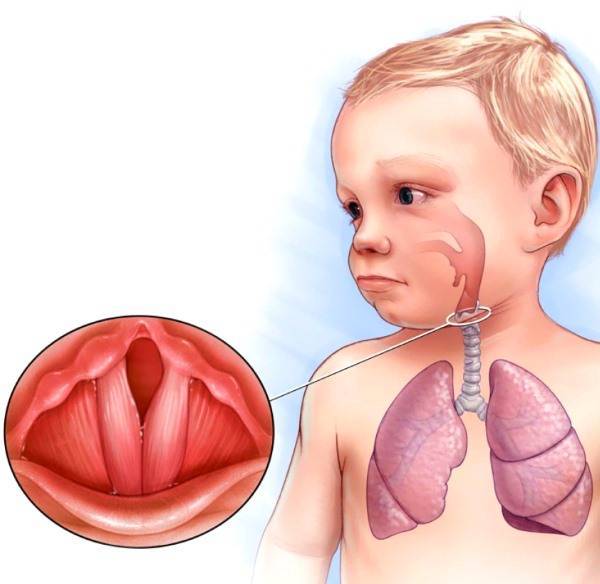 У ребенка долго не проходит сухой кашель — что нужно знать для избавления от проблемы?