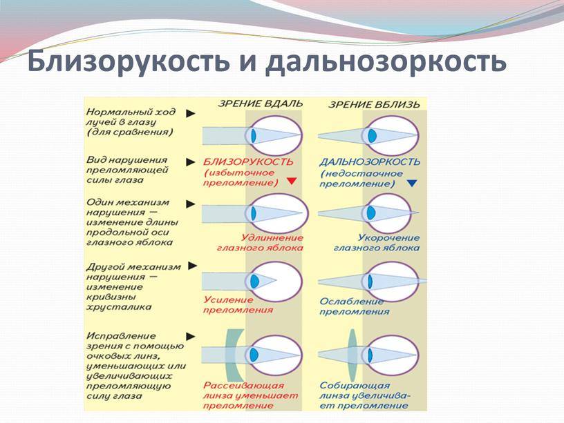 Современные методы лечения близорукости у детей - энциклопедия ochkov.net