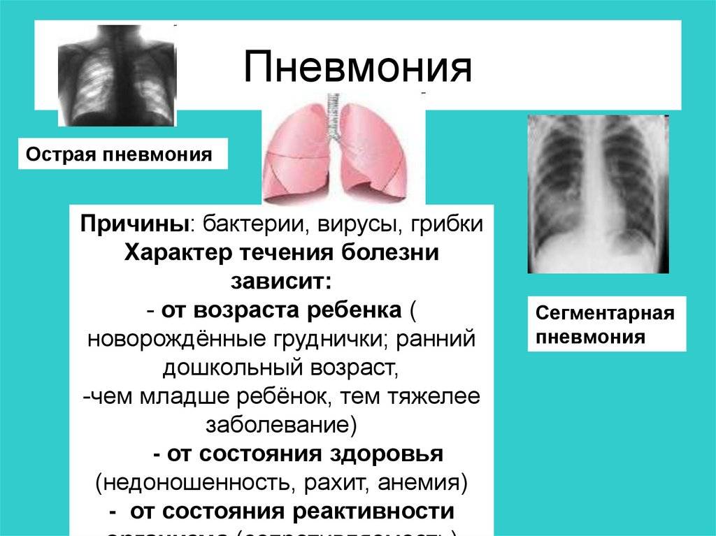 Признаки пневмонии у детей