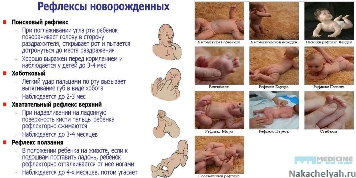 Рефлексы Бабинского, Галанта, Бабкина и Моро у новорожденного и таблица по месяцам