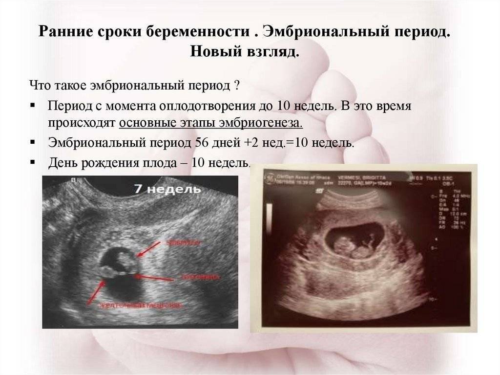 Как рассчитать срок беременности: 5 способов и их сравнение | курсы и тренинги от лары серебрянской