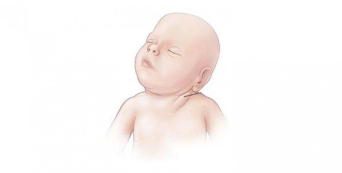 Почему у ребенка болит шея сзади: причины патологического состояния и лечение