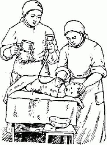 Промывание желудка у детей: алгоритм, подготовка, техника | elesto.ru