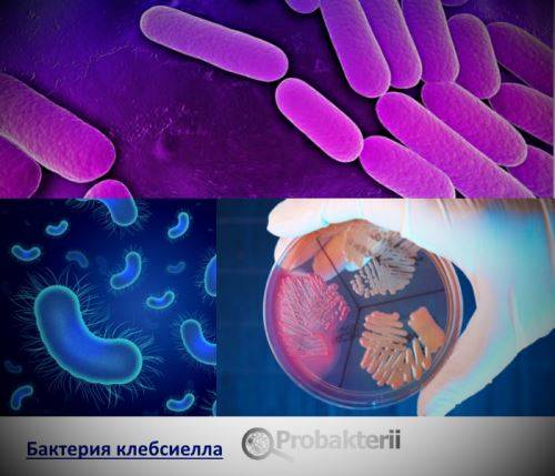 Клебсиелла пневмония у грудничков: признаки, пути инфицирования и лечение - центральная городская больница гуз яо дкб №1