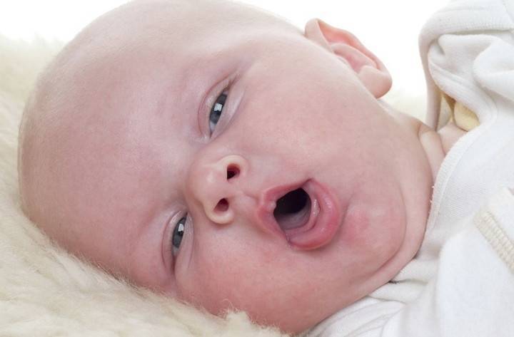 Различия конъюнктивита и дакриоцистита у новорожденных