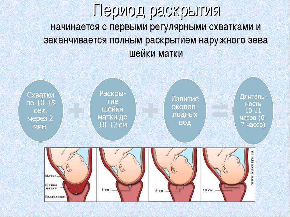 Воды отошли, а схваток нет? что делать в случае преждевременного излития вод при доношенной беременности (37+ недель)?