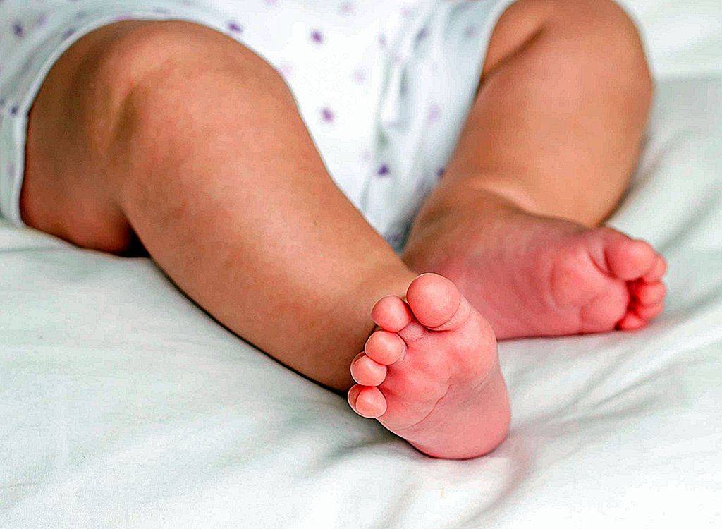 Запах ног у детей: лечение запаха ног у детей, прием дерматолога в москве